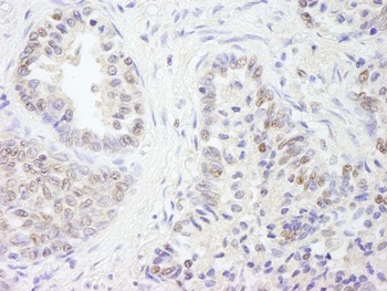 Rabbit anti-UBE1 Antibody