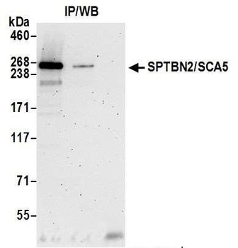 Rabbit anti-SPTBN2/SCA5 Antibody