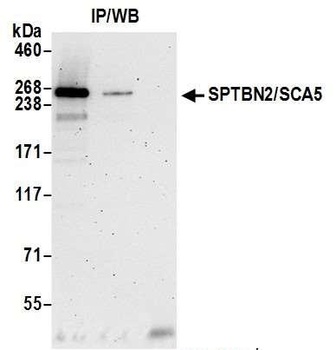 SPTBN2/SCA5 Antibody