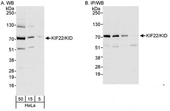Rabbit KIF22/KID Antibody