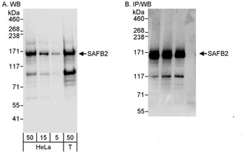 Rabbit anti-SAFB2 Antibody