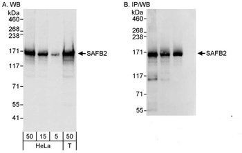 Rabbit anti-SAFB2 Antibody