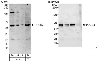 Rabbit PDCD4 Antibody