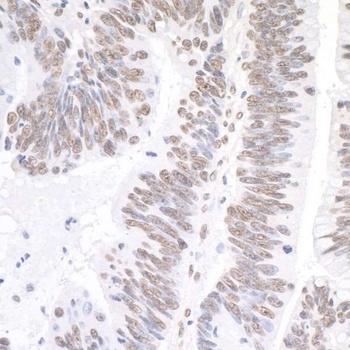 Rabbit anti-XRN2 Antibody