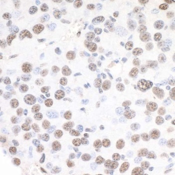 Rabbit anti-XRN2 Antibody