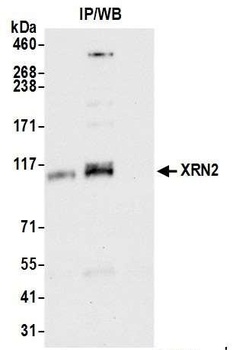 Rabbit anti-XRN2 Antibody