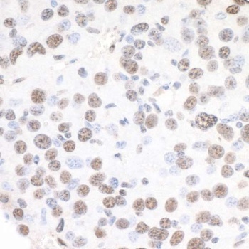 XRN2 Antibody