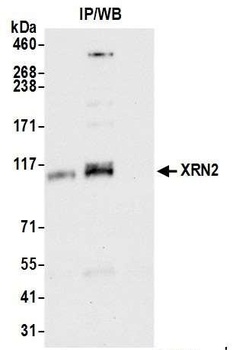 XRN2 Antibody