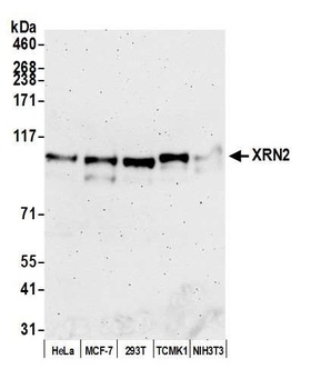 Rabbit XRN2 Antibody