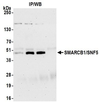 SMARCB1/SNF5 Antibody