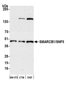 SMARCB1/SNF5 Antibody
