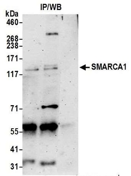 SMARCA1/SNF2L Antibody