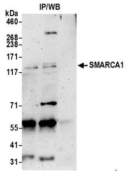 Rabbit anti-SMARCA1/SNF2L Antibody