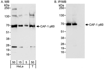 Rabbit anti-CAF-1 p60 Antibody