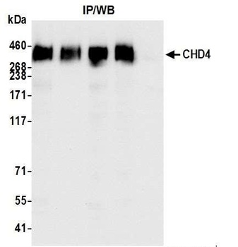 Rabbit anti-CHD4 Antibody
