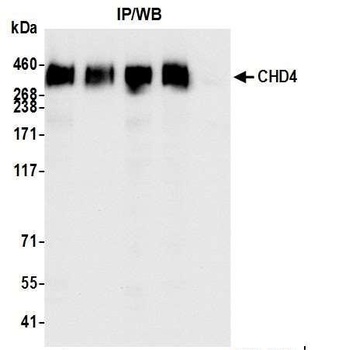 Rabbit anti-CHD4 Antibody