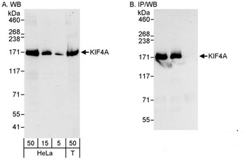 Rabbit KIF4A Antibody