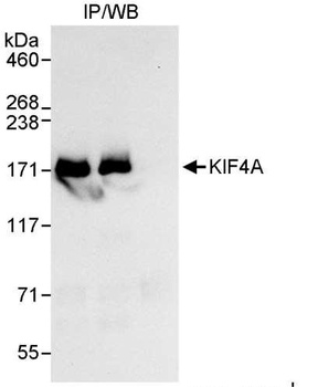 Rabbit KIF4A Antibody