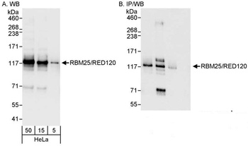 Rabbit anti-RBM25/RED120 Antibody