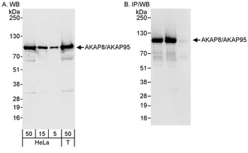 Rabbit anti-AKAP8/AKAP95 Antibody