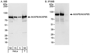 AKAP8/AKAP95 Antibody