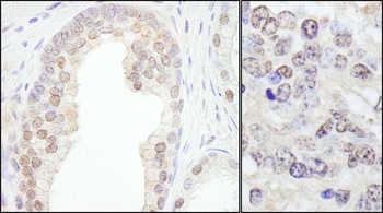 Rabbit anti-TRIM33/TIF1gamma Antibody