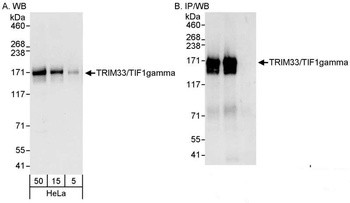 Rabbit anti-TRIM33/TIF1gamma Antibody
