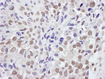 Rabbit anti-TRIM33/TIF1gamma Antibody