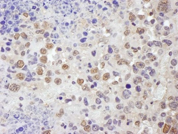 Rabbit anti-TRIM33/TIF1gamma Antibody