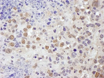 TRIM33/TIF1gamma Antibody