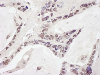 Rabbit ARID1B Antibody
