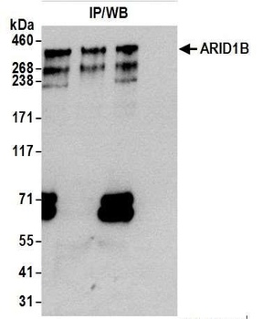 ARID1B Antibody