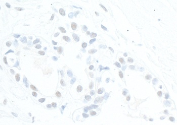 ATRX Antibody