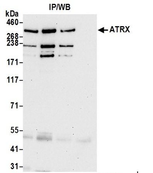 ATRX Antibody