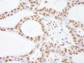 Rabbit anti-SMARCC2/BAF170 Antibody