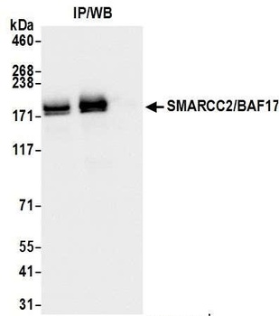 SMARCC2/BAF170 Antibody