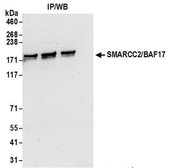 SMARCC2/BAF170 Antibody