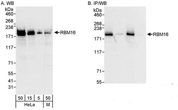 Rabbit anti-RBM16 Antibody