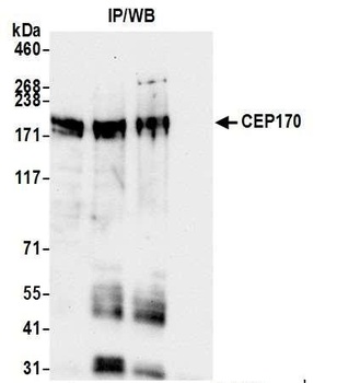 CEP170 Antibody