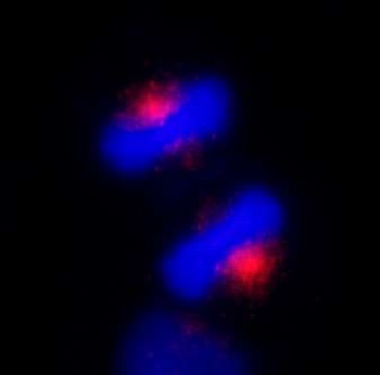 Rabbit anti-CEP170 Antibody