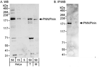 Rabbit PNN/Pinin Antibody