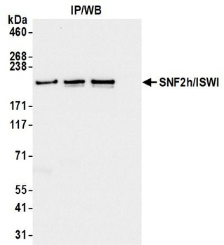Rabbit anti-SNF2h/ISWI/SMARCA5 Antibody