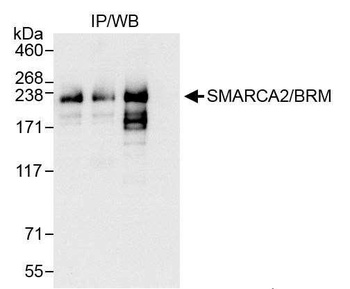 Rabbit anti-SMARCA2/BRM Antibody