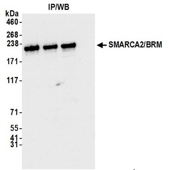 Rabbit anti-SMARCA2/BRM Antibody