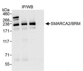 Rabbit anti-SMARCA2/BRM Antibody