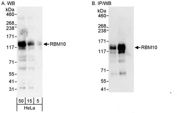 Rabbit anti-RBM10 Antibody