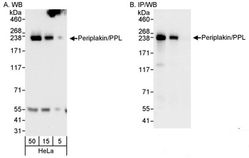 Periplakin/PPL Antibody