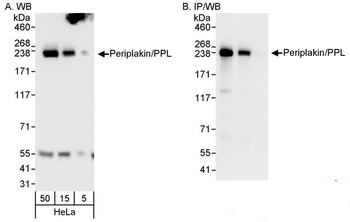 Rabbit anti-Periplakin/PPL Antibody
