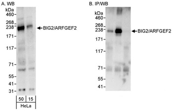 BIG2/ARFGEF2 Antibody