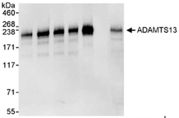 Goat ADAMTS13 Antibody